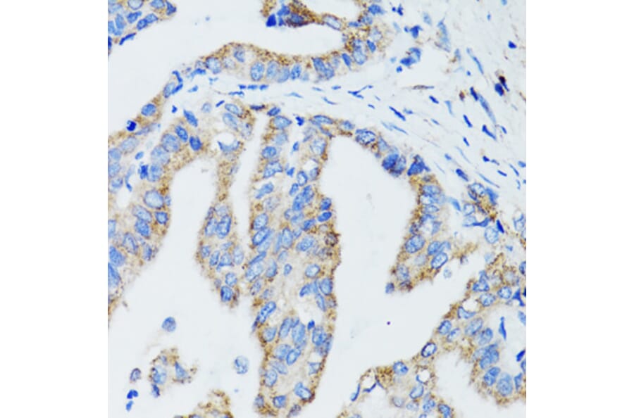 Immunohistochemistry - Anti-USO1 Antibody (A2796) - Antibodies.com
