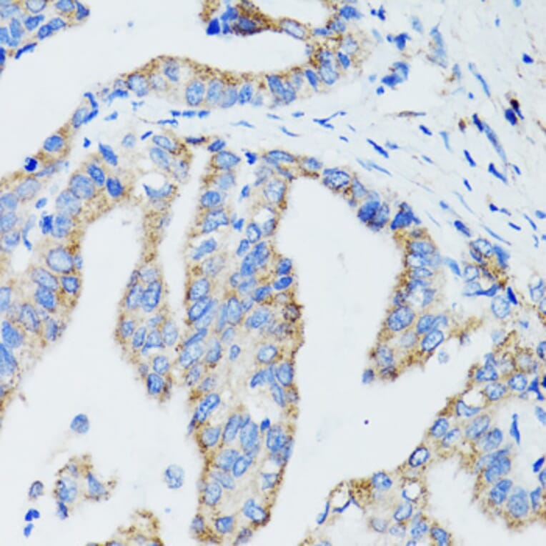 Immunohistochemistry - Anti-USO1 Antibody (A2796) - Antibodies.com