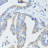 Immunohistochemistry - Anti-USO1 Antibody (A2796) - Antibodies.com