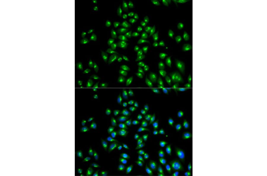 Immunofluorescence - Anti-USO1 Antibody (A2796) - Antibodies.com
