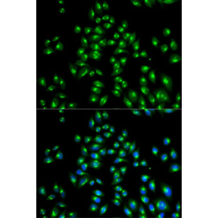 Immunofluorescence - Anti-USO1 Antibody (A2796) - Antibodies.com