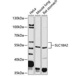 Western Blot - Anti-VMAT2 Antibody (A14200) - Antibodies.com