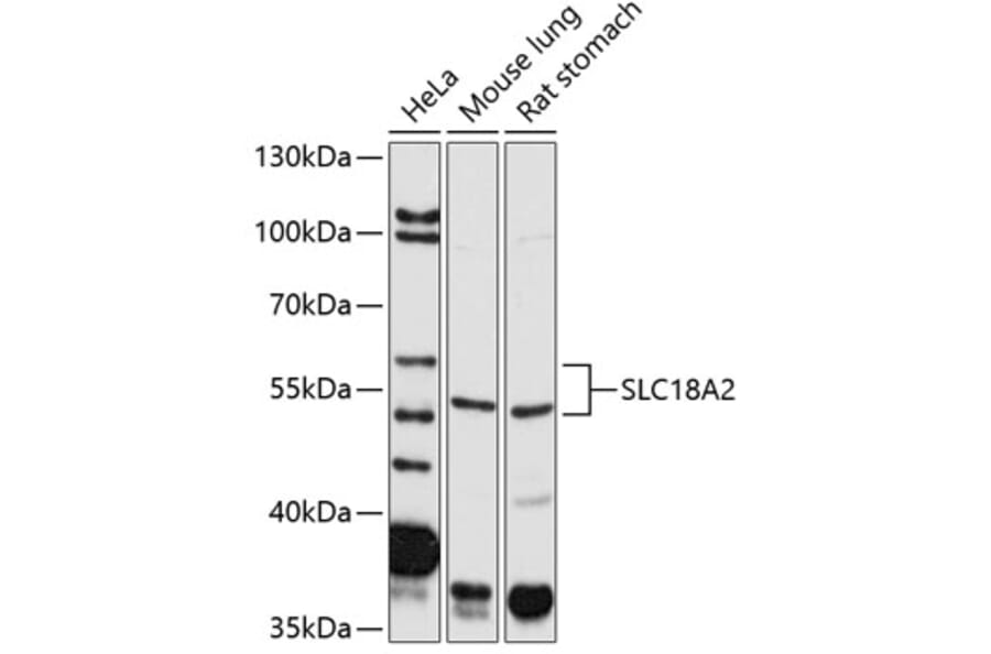 Western Blot - Anti-VMAT2 Antibody (A14200) - Antibodies.com