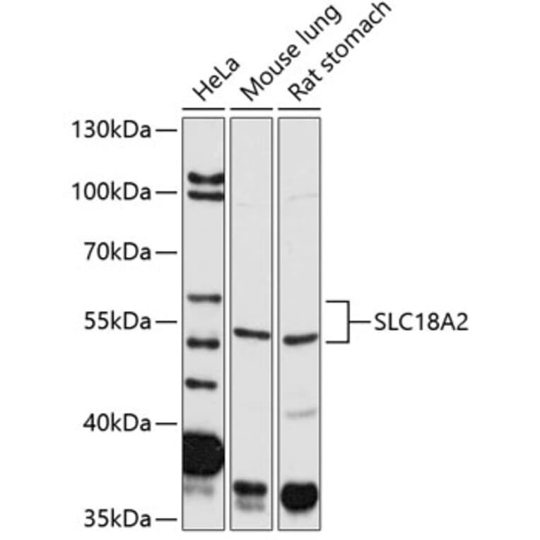 Western Blot - Anti-VMAT2 Antibody (A14200) - Antibodies.com