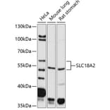 Western Blot - Anti-VMAT2 Antibody (A14200) - Antibodies.com