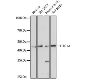Western Blot - Anti-5HT1A Receptor Antibody (A14202) - Antibodies.com