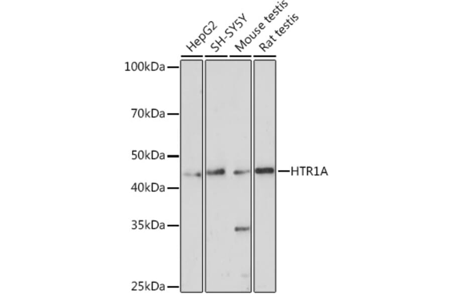 Western Blot - Anti-5HT1A Receptor Antibody (A14202) - Antibodies.com