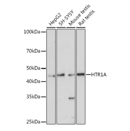 Western Blot - Anti-5HT1A Receptor Antibody (A14202) - Antibodies.com