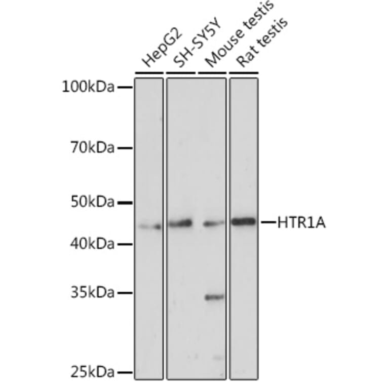 Western Blot - Anti-5HT1A Receptor Antibody (A14202) - Antibodies.com