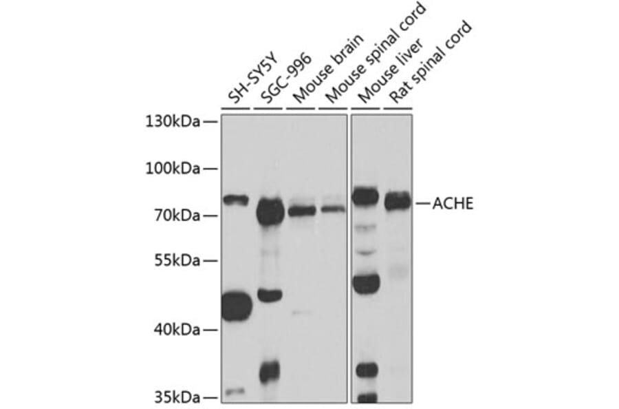 Western Blot - Anti-Acetylcholinesterase Antibody (A14203) - Antibodies.com
