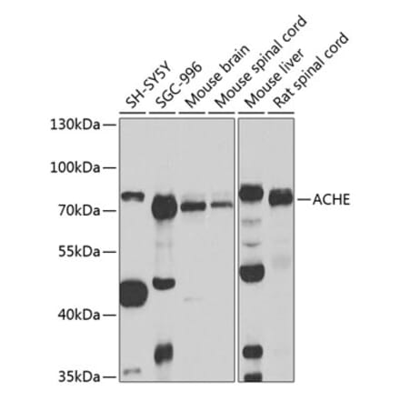 Western Blot - Anti-Acetylcholinesterase Antibody (A14203) - Antibodies.com