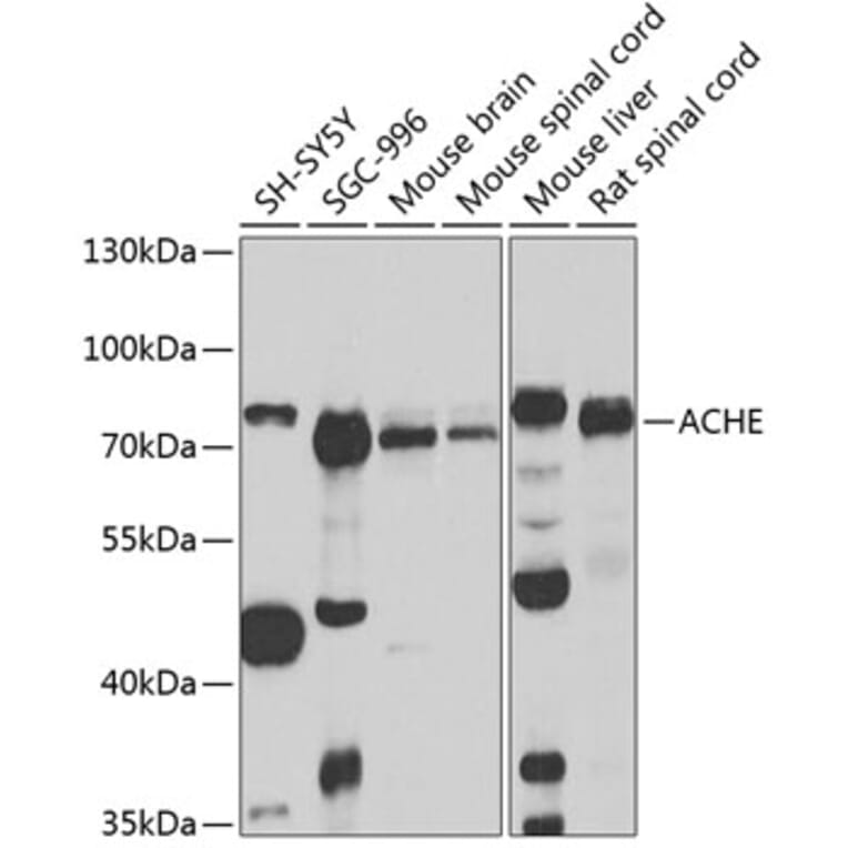 Western Blot - Anti-Acetylcholinesterase Antibody (A14203) - Antibodies.com