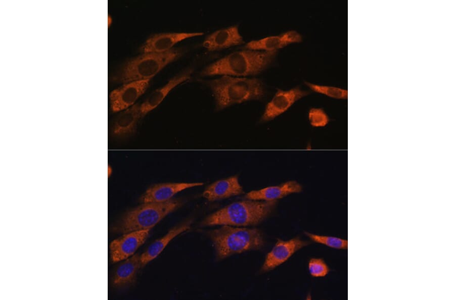 Immunofluorescence - Anti-Acetylcholinesterase Antibody (A14203) - Antibodies.com