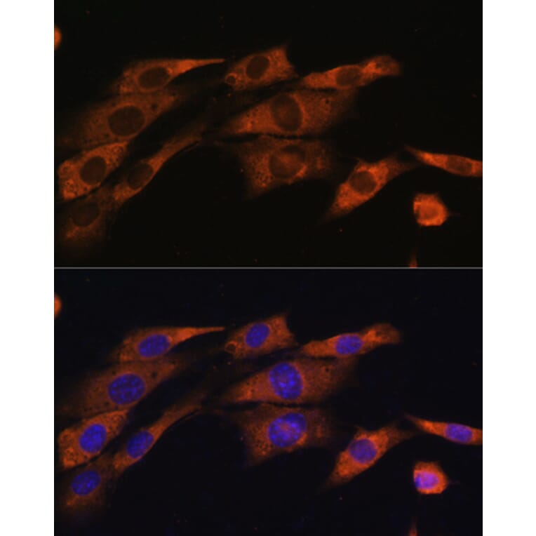Immunofluorescence - Anti-Acetylcholinesterase Antibody (A14203) - Antibodies.com