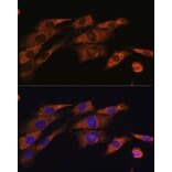 Immunofluorescence - Anti-Acetylcholinesterase Antibody (A14203) - Antibodies.com