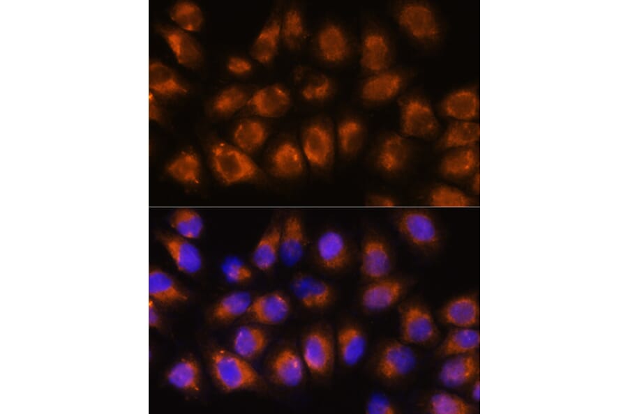 Immunofluorescence - Anti-Acetylcholinesterase Antibody (A14203) - Antibodies.com