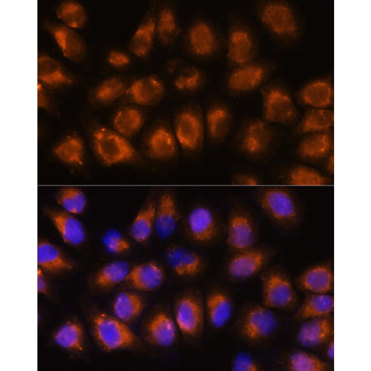 Immunofluorescence - Anti-Acetylcholinesterase Antibody (A14203) - Antibodies.com