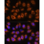 Immunofluorescence - Anti-Acetylcholinesterase Antibody (A14203) - Antibodies.com