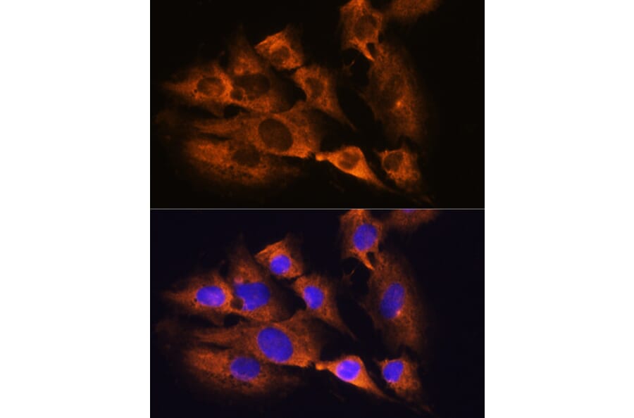 Immunofluorescence - Anti-Acetylcholinesterase Antibody (A14203) - Antibodies.com