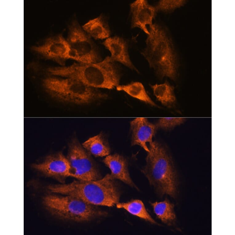 Immunofluorescence - Anti-Acetylcholinesterase Antibody (A14203) - Antibodies.com