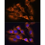 Immunofluorescence - Anti-Acetylcholinesterase Antibody (A14203) - Antibodies.com