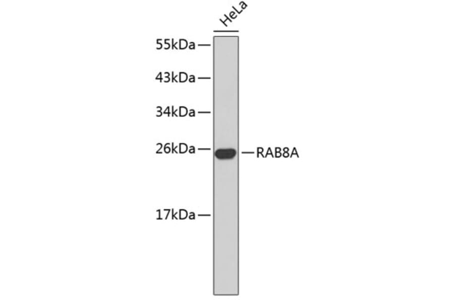 Western Blot - Anti-RAB8A Antibody (A14206) - Antibodies.com