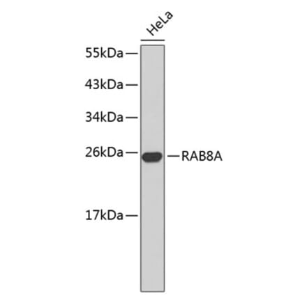 Western Blot - Anti-RAB8A Antibody (A14206) - Antibodies.com