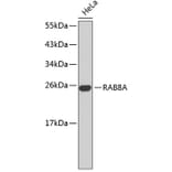 Western Blot - Anti-RAB8A Antibody (A14206) - Antibodies.com