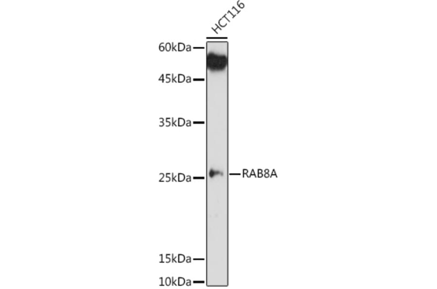 Western Blot - Anti-RAB8A Antibody (A14206) - Antibodies.com