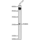 Western Blot - Anti-RAB8A Antibody (A14206) - Antibodies.com