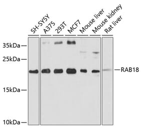 Western Blot - Anti-Rab18 Antibody (A14207) - Antibodies.com