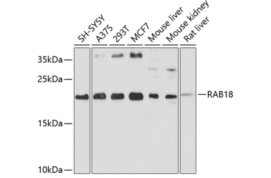 Western Blot - Anti-Rab18 Antibody (A14207) - Antibodies.com