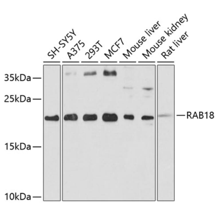 Western Blot - Anti-Rab18 Antibody (A14207) - Antibodies.com