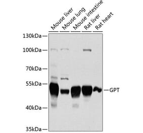 Western Blot - Anti-Alanine Transaminase Antibody (A14209) - Antibodies.com