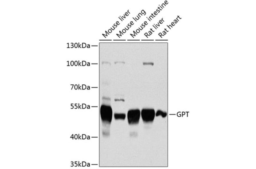 Western Blot - Anti-Alanine Transaminase Antibody (A14209) - Antibodies.com