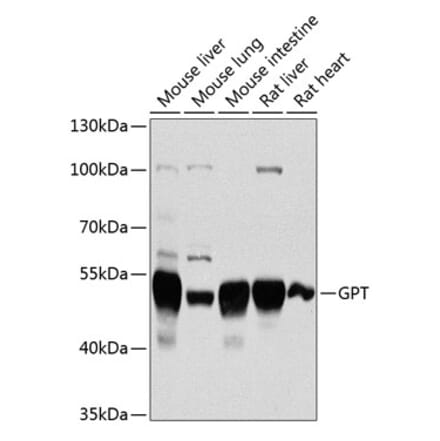 Western Blot - Anti-Alanine Transaminase Antibody (A14209) - Antibodies.com
