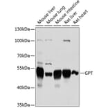 Western Blot - Anti-Alanine Transaminase Antibody (A14209) - Antibodies.com