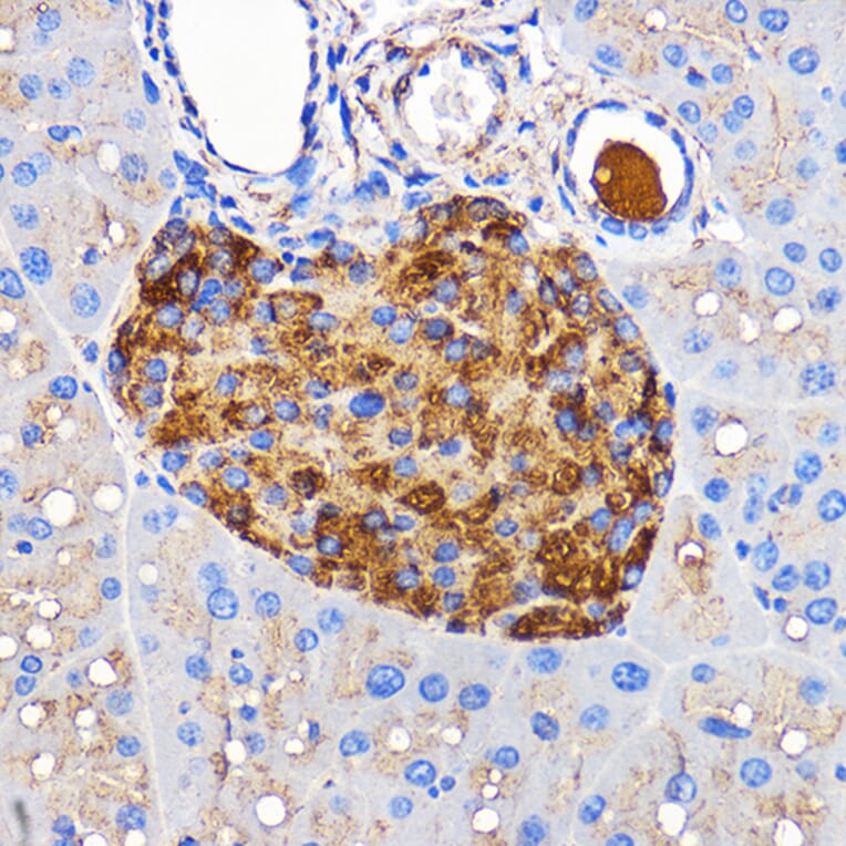 Immunohistochemistry - Anti-Amylin/DAP Antibody (A14211) - Antibodies.com