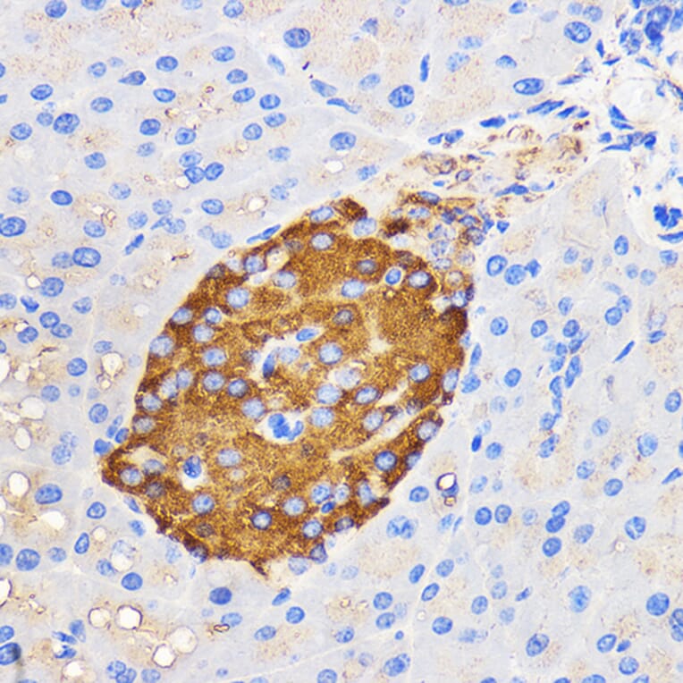 Immunohistochemistry - Anti-Amylin/DAP Antibody (A14211) - Antibodies.com