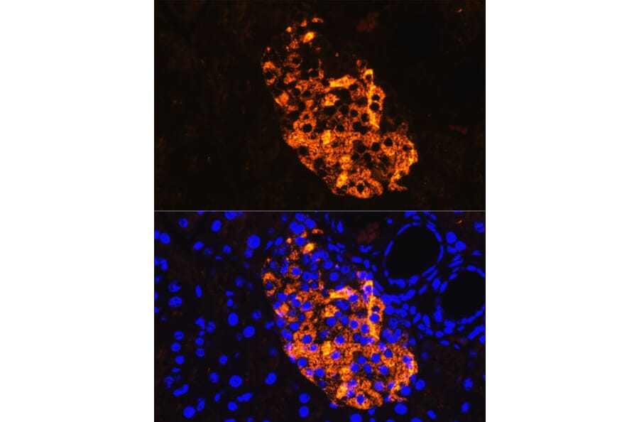 Immunofluorescence - Anti-Amylin/DAP Antibody (A14211) - Antibodies.com