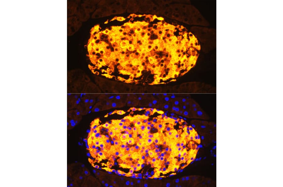 Immunofluorescence - Anti-Amylin/DAP Antibody (A14211) - Antibodies.com