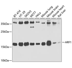 Western Blot - Anti-ARF1 Antibody (A14212) - Antibodies.com