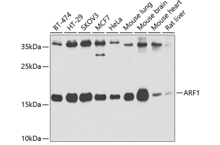 Western Blot - Anti-ARF1 Antibody (A14212) - Antibodies.com