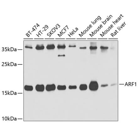 Western Blot - Anti-ARF1 Antibody (A14212) - Antibodies.com