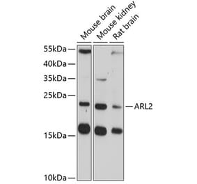 Western Blot - Anti-ARL2 Antibody (A14214) - Antibodies.com