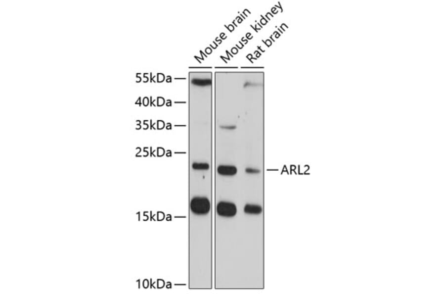 Western Blot - Anti-ARL2 Antibody (A14214) - Antibodies.com