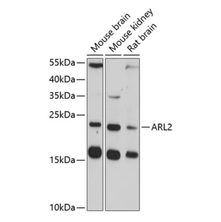 Western Blot - Anti-ARL2 Antibody (A14214) - Antibodies.com