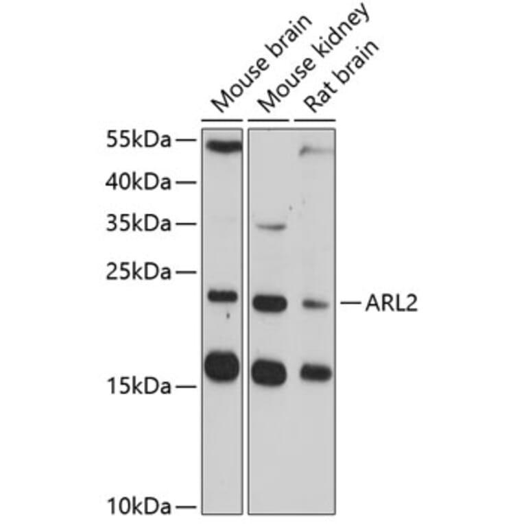 Western Blot - Anti-ARL2 Antibody (A14214) - Antibodies.com