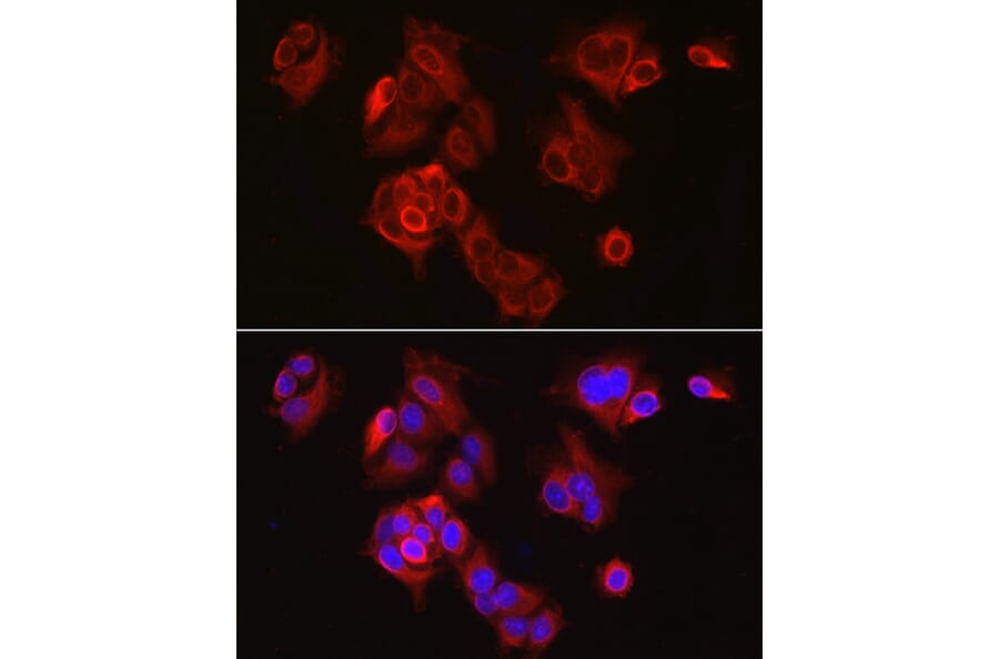 Immunofluorescence - Anti-SLC7A5/LAT1 Antibody (A14216) - Antibodies.com