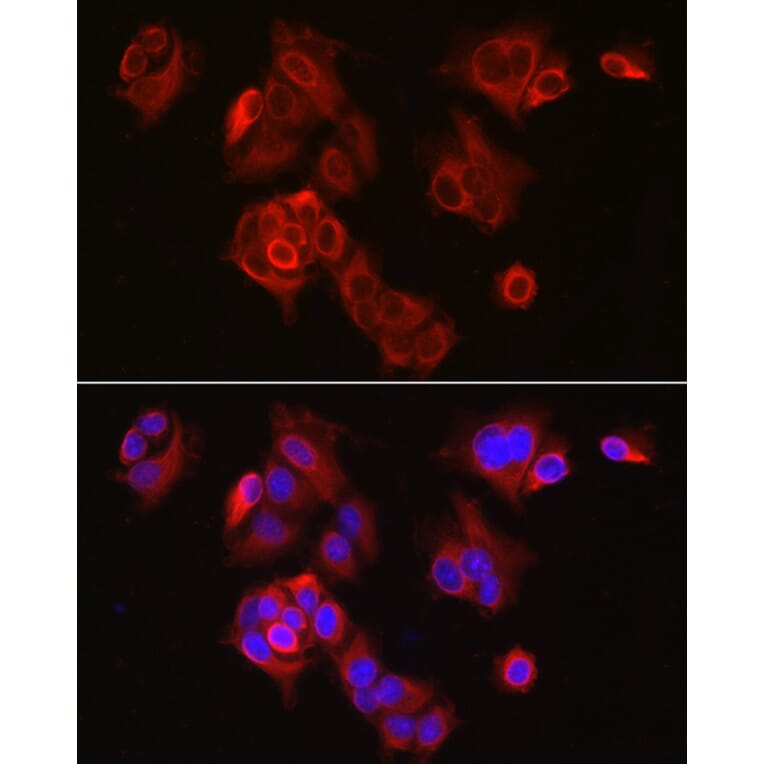 Immunofluorescence - Anti-SLC7A5/LAT1 Antibody (A14216) - Antibodies.com